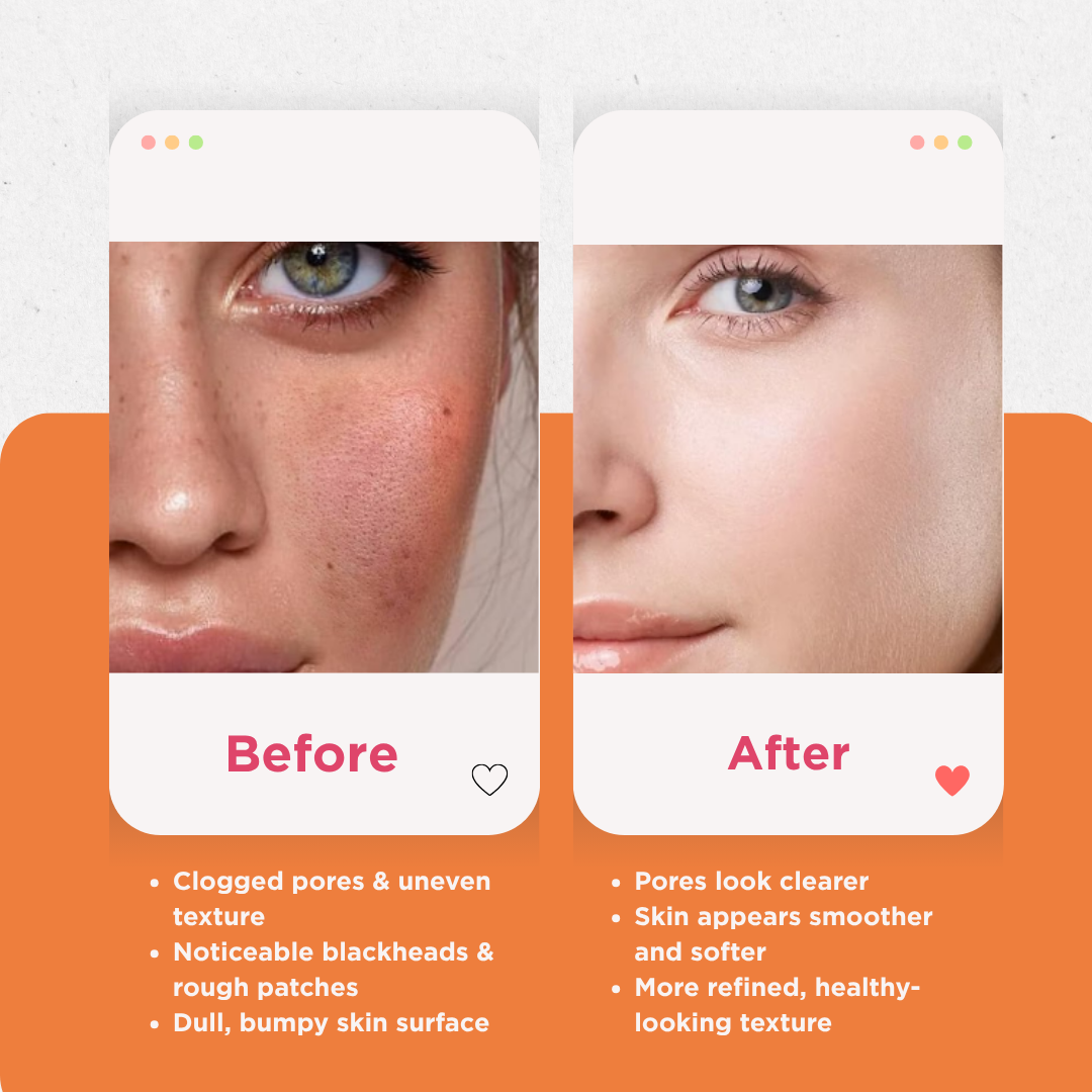 Turmeric & Kojic Acid Cleansing Pads