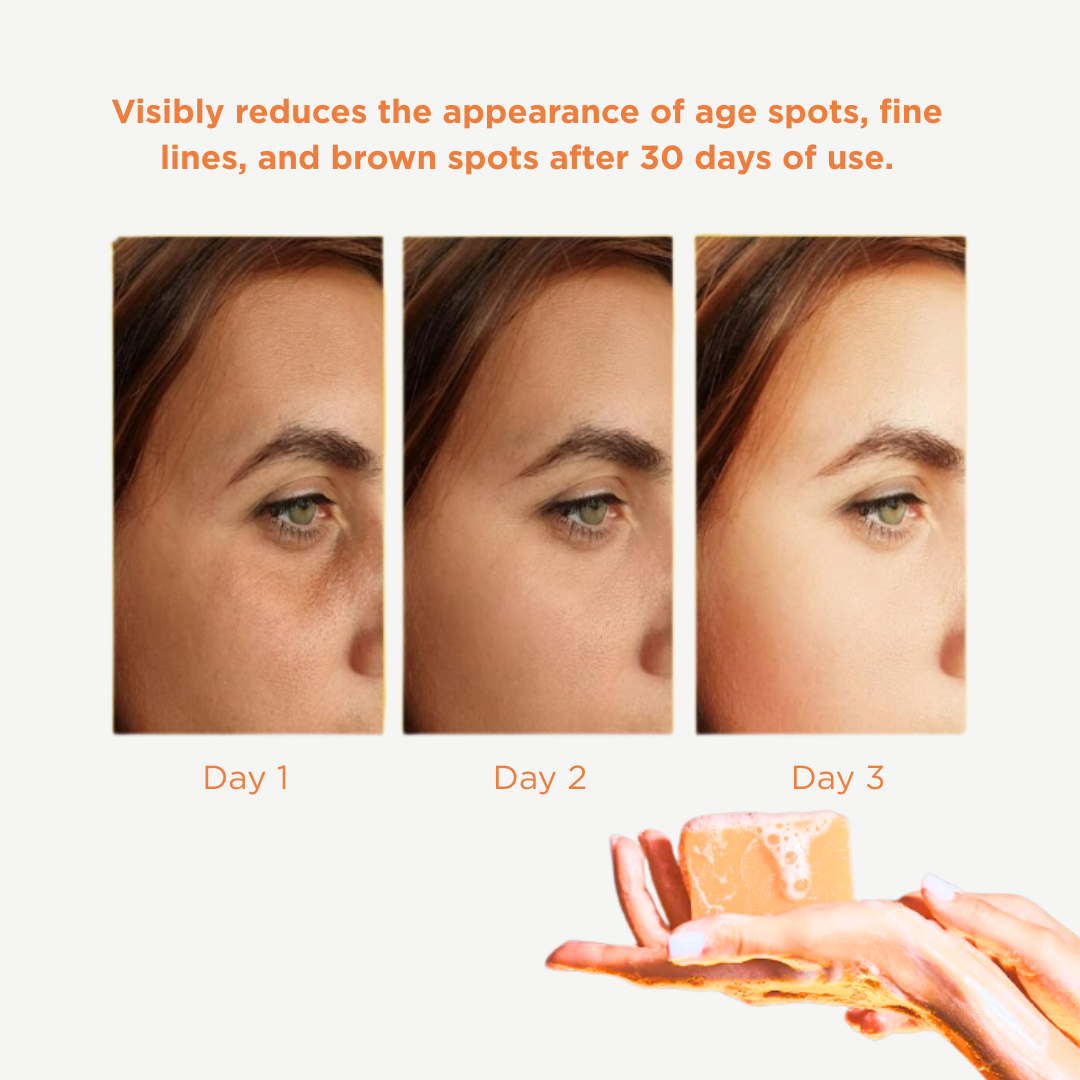 Tumeric & Kojic Acid Soap