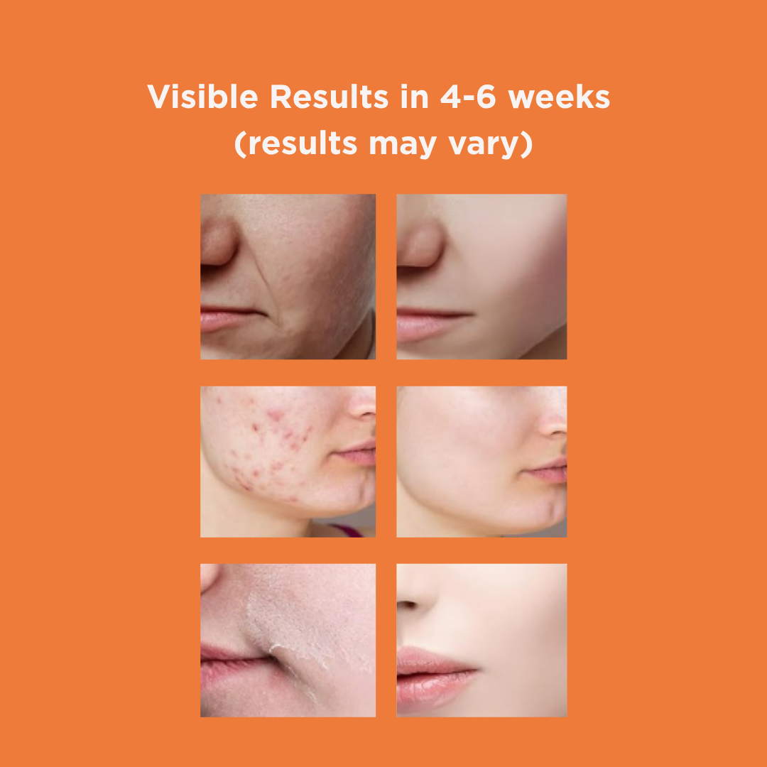 Turmeric & Kojic Acid Cleansing Pads